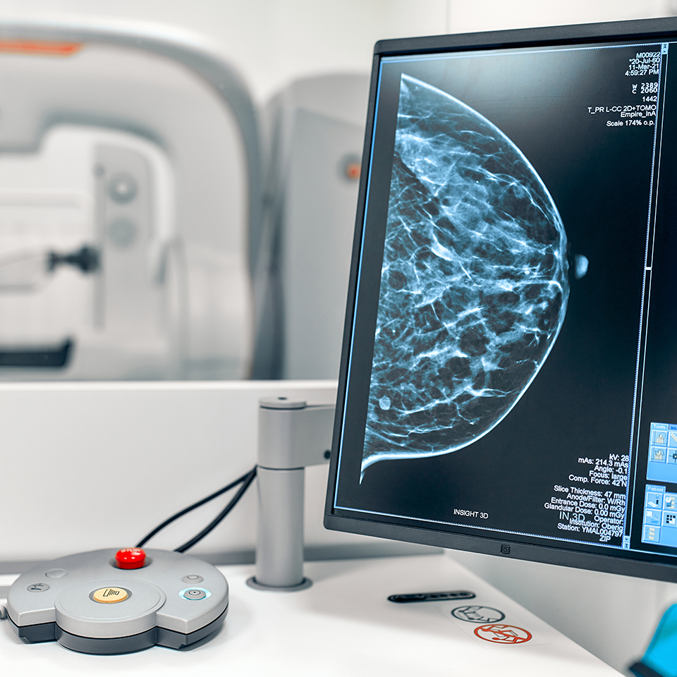 Mamografías y Densitometrias Óseas en Madrid Sur